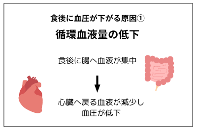 循環血液量の低下